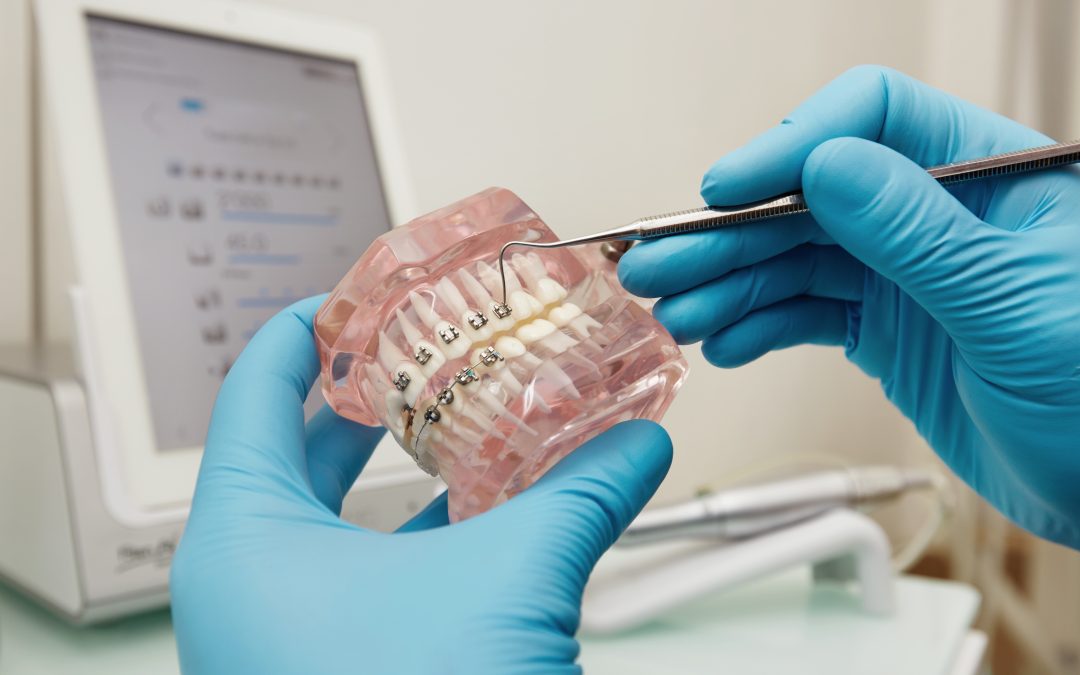 What to Expect : A Closer Look at Orthodontic Visits